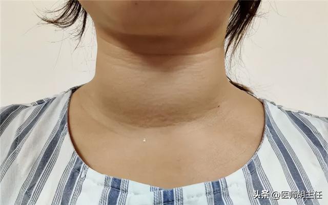 人为什么会出汗，为什么人非常能出汗是什么原因（人为什么会出汗）