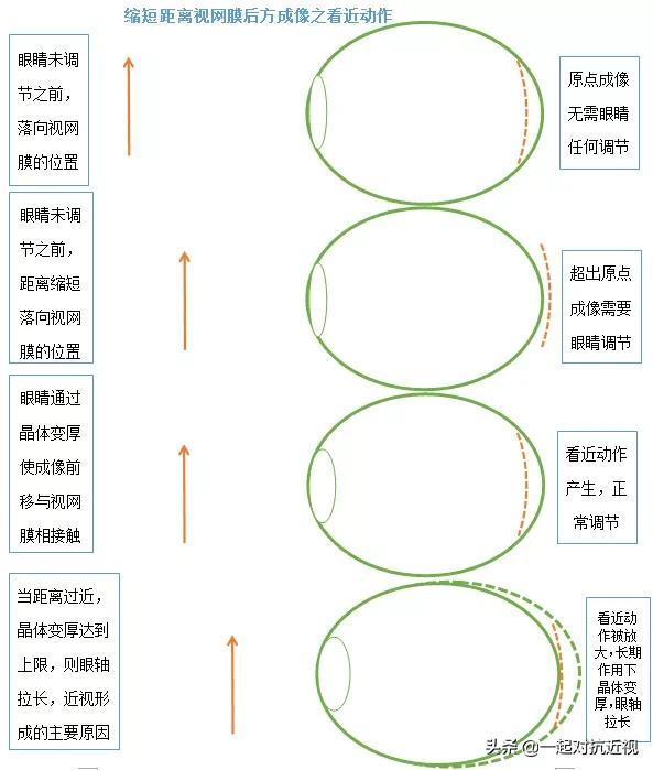 眼睛的成像原理示意图，眼睛所有成像过程一览