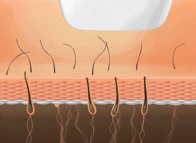 缩毛孔最有效方法，收缩毛孔最好的方法