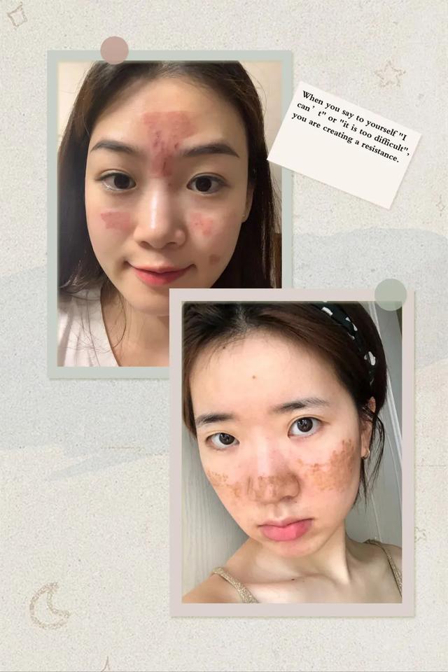 缩毛孔最有效方法，收缩毛孔最好的方法