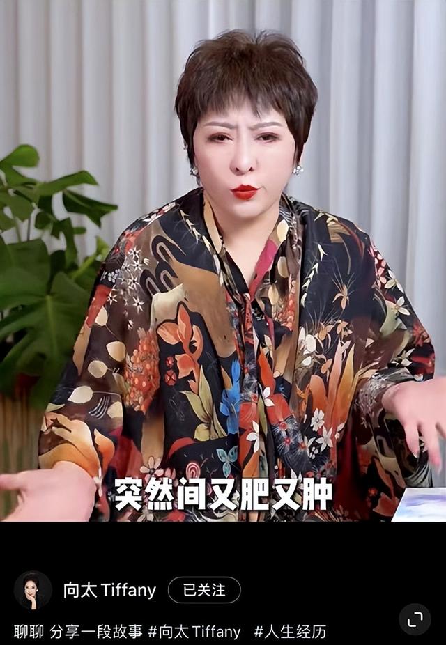 下垂体肥胖(垂体 肥胖)