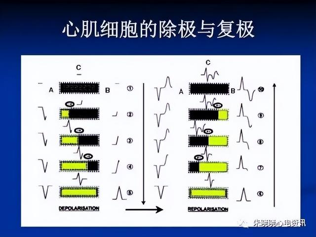 一分钟快速看懂心电图，1分钟教你看懂心电图