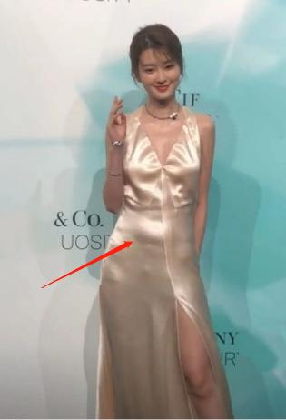 腹部肥胖骨盆(胖人骨盆条件咋样)