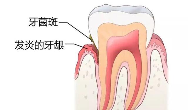 漱口水可以喝吗，清新口气的漱口水可以喝吗（男子喝漱口水被测出酒驾）