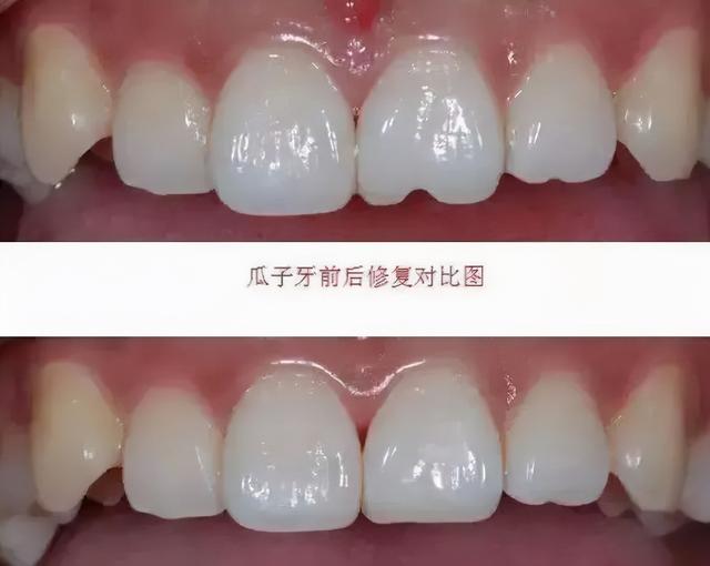怎么正确的嗑瓜子，来学习正确吃“瓜”知识