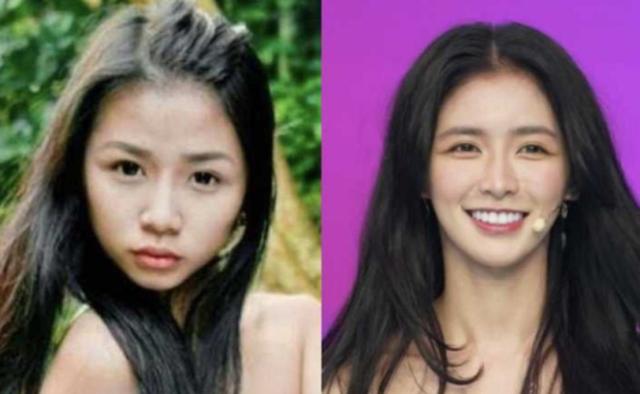 换脸成功的人，顶着“面具脸”41年苦不堪言