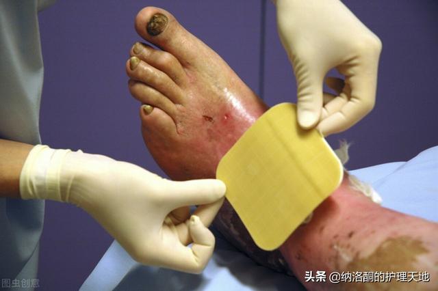 糖尿病眼瞎(糖尿病眼瞎了还能治好吗)