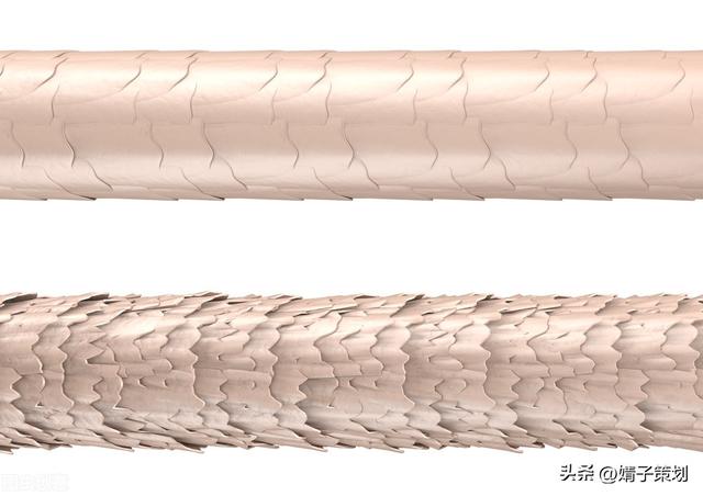 皮肤组织结构图，皮肤组织示意图讲解