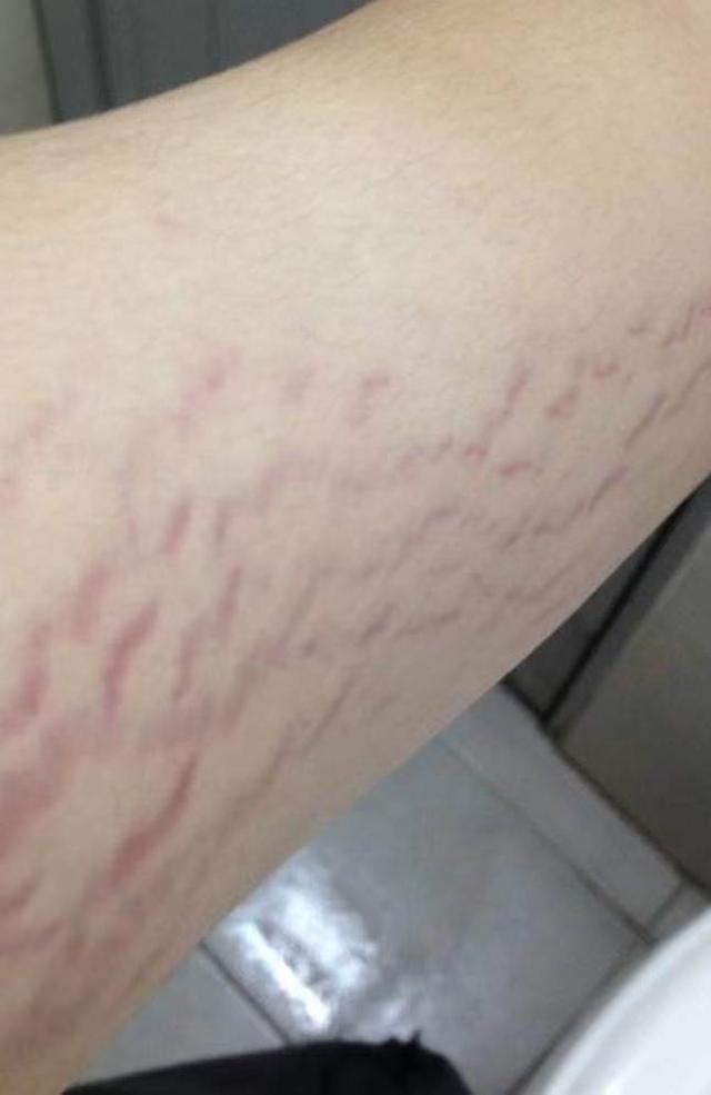 娇韵诗妊娠油测评，妊娠油该如何选择