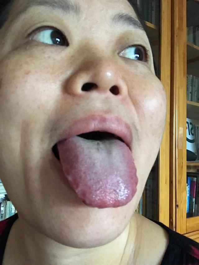  舌象知病图解，23张高清案例图