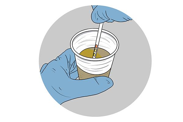 尿酸 肥胖(尿酸肥胖)