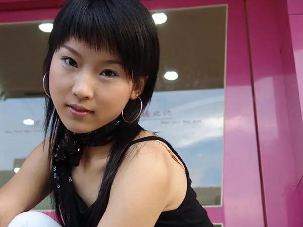 换脸成功的人，顶着“面具脸”41年苦不堪言