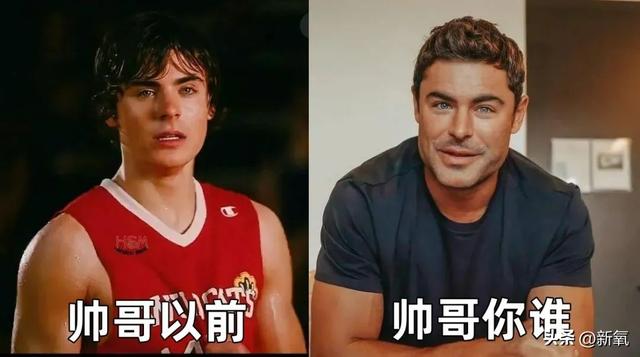 男性肥胖下颌骨整形(男性下颌骨宽大)
