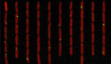 6号微小染色体缺失，英国女孩变成“三无人类”