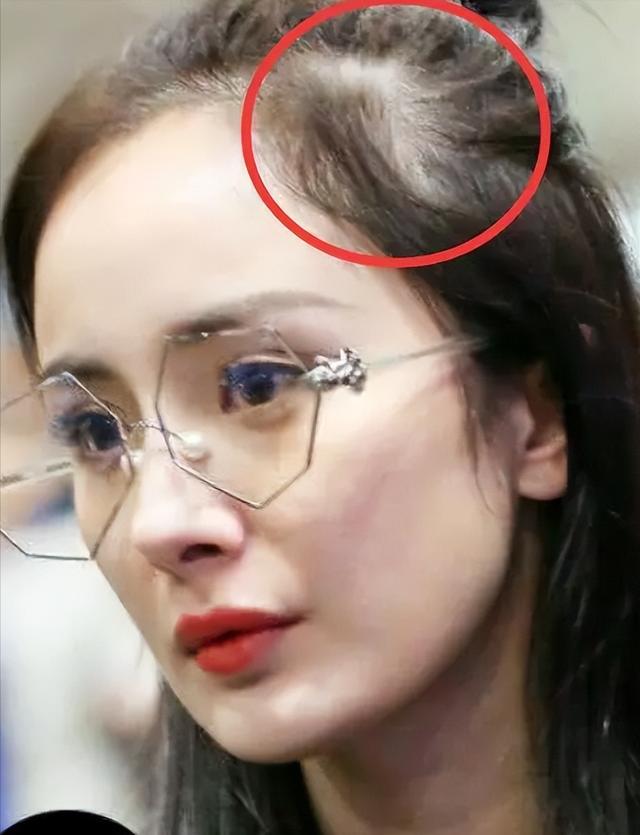 肥胖与发量(胖和头发少有关系么)