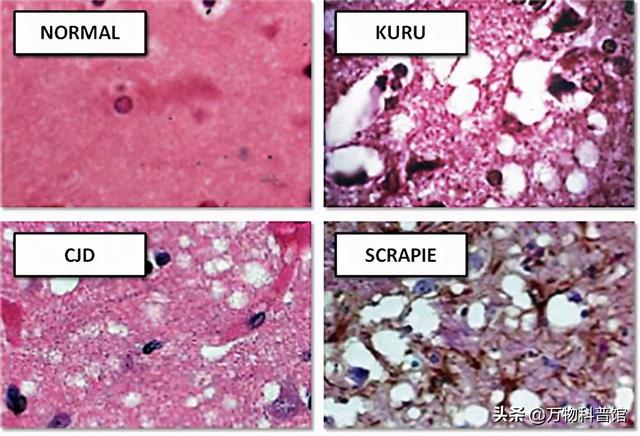 朊病毒到底是一种什么东西，千万别吃同类的肉