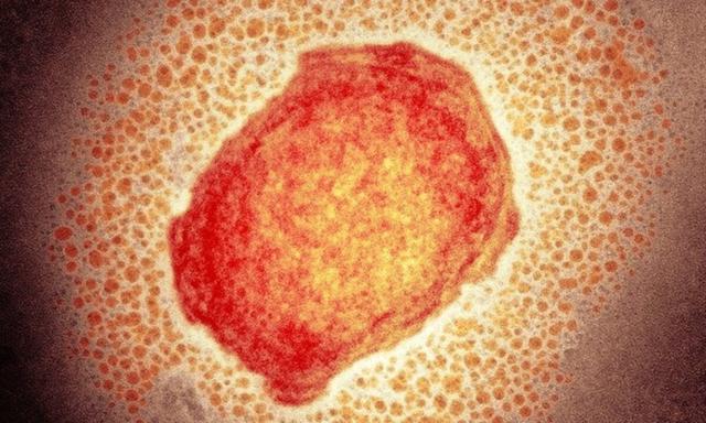 美国的猴痘是因为什么引起的，美国祸不单行