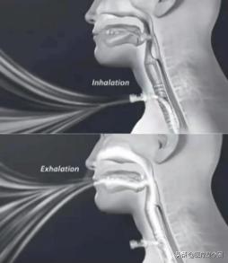 正常人的声带图片，喉咙切开插管能说话吗（关于喉头、声带的10个秘密）