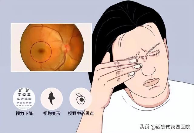 怀孕会加速糖尿病吗(怀孕会加速糖尿病进程吗)