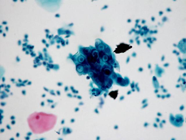 常见性传播疾病有哪些，7种通过性传播的疾病