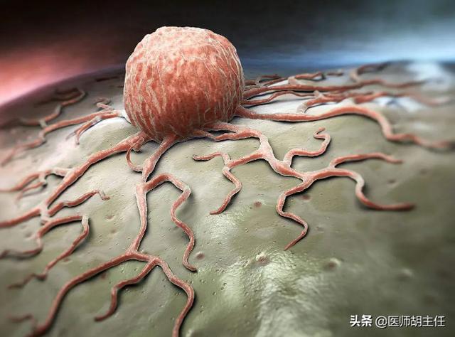 脂肪瘤怎么治疗最好的方法，正常人为什么会出现脂肪瘤