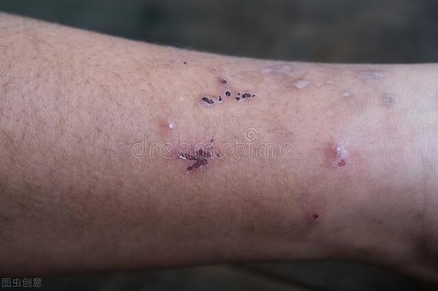 男人有了糖尿病就完了(男人有了糖尿病怎么能过夫妻生活)