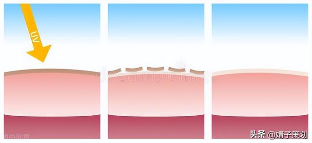 皮肤组织结构图，皮肤组织示意图讲解
