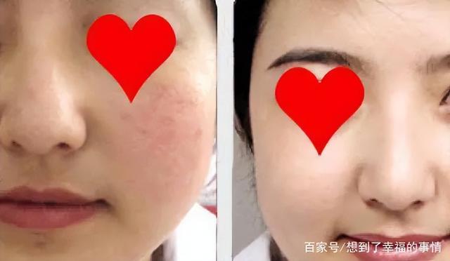 螨虫最怕的土办法，家里老人小孩老过敏
