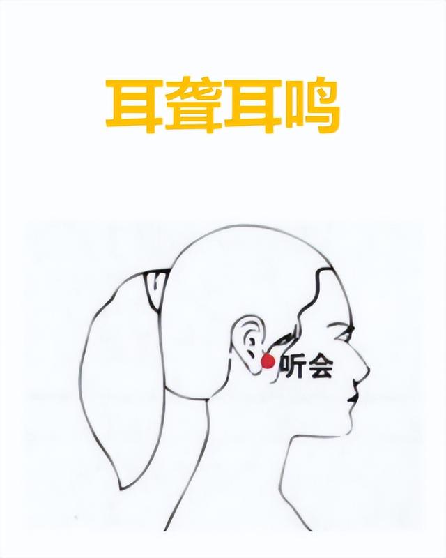 80个主要穴位歌诀值得收藏，经典：中医针灸80穴主治歌诀