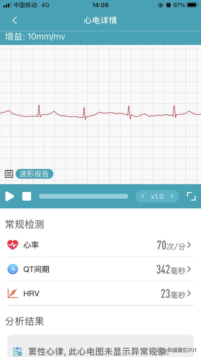 各指标正常值，24个常见的身体检查指标