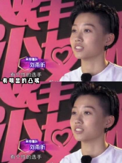 换脸成功的人，顶着“面具脸”41年苦不堪言