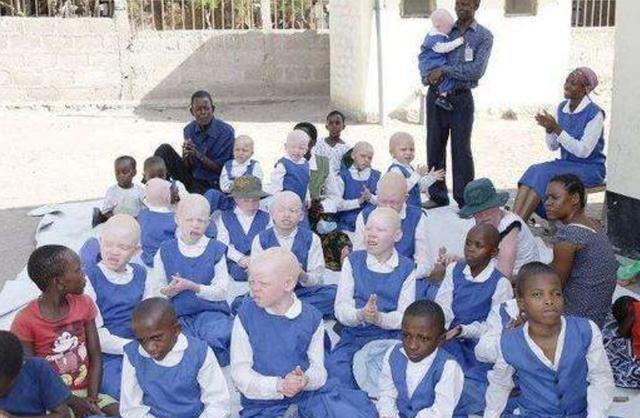 人类白化病的直接原因，非洲的白化病人