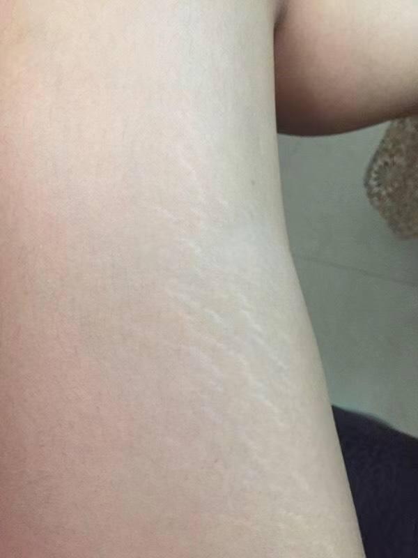 娇韵诗妊娠油测评，妊娠油该如何选择