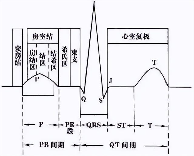 一分钟快速看懂心电图，1分钟教你看懂心电图