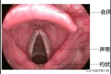 正常人的声带图片，喉咙切开插管能说话吗（关于喉头、声带的10个秘密）