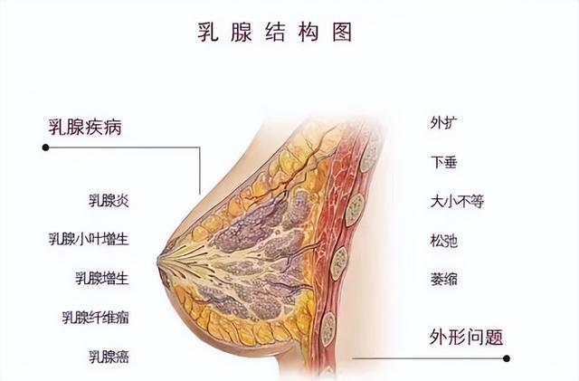 怎么预防乳腺癌，大多数女性都不知道（怎么样分辨乳腺癌是早期和晚期）