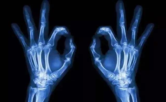 伦琴射线是宇宙射线吗，伦琴与X射线的发现是一个偶然的巧合