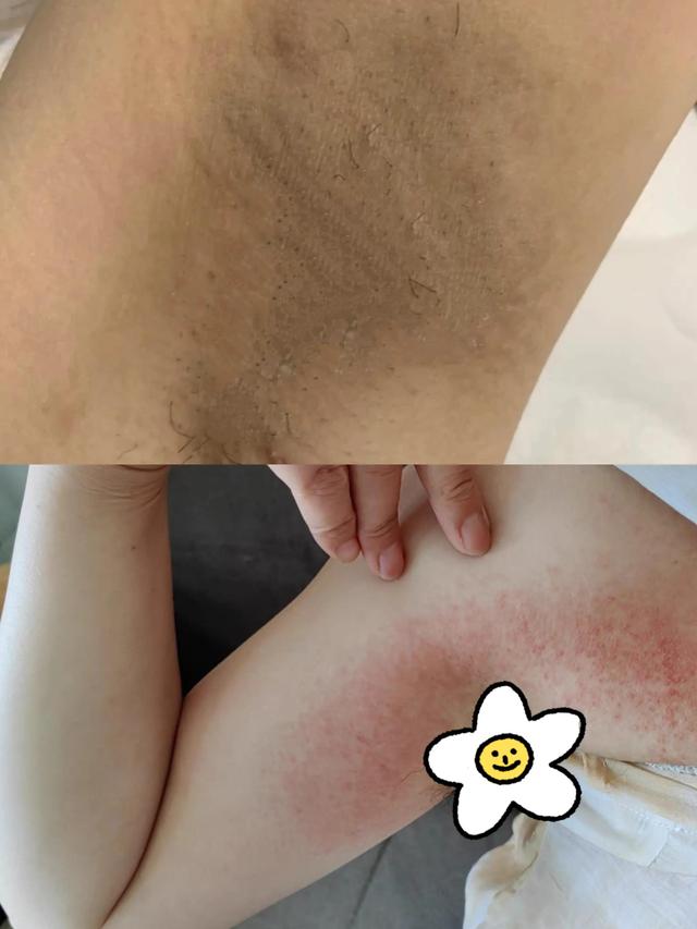 用什么药能掩盖腋臭呢(什么可以掩盖)