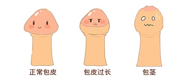 男人常见十大疾病，男性一生中最常见的五种疾病