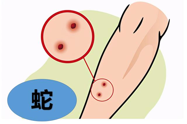 21岁小伙被神秘毒蛇咬伤，广西70岁老伯欲吓唬毒蛇反被追着咬