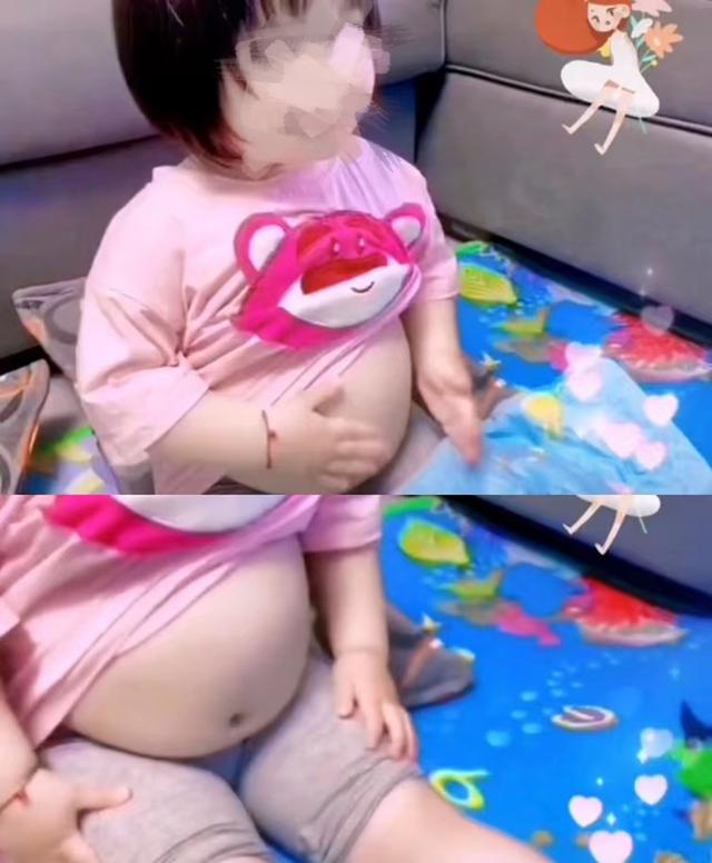 幼儿肥胖症状(幼儿肥胖症状体征有哪些)