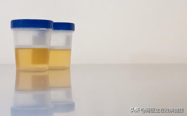 有来糖尿病(来糖尿病人可以吃南瓜吗)
