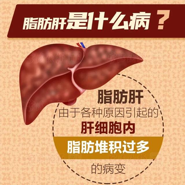 脂肪肝会糖尿病吗(脂肪肝糖尿病有关联吗)