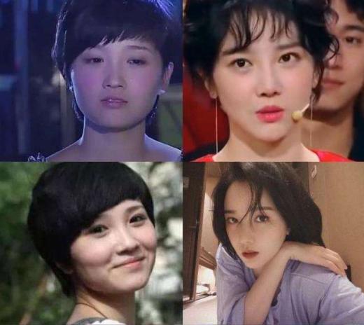 换脸成功的人，顶着“面具脸”41年苦不堪言