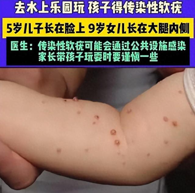 游泳馆会不会传染腋臭(游泳馆会不会传染新冠)