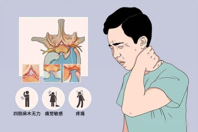 肩颈酸痛的厉害是什么原因，五大原因六大方法来缓解