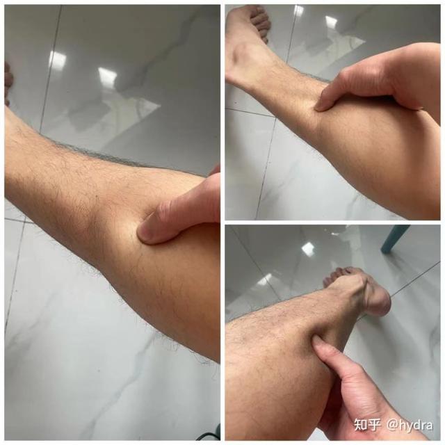 正确的肌肉贴法，膏药正确用法看这里