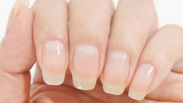 严重缺维生素指甲图片，指甲有这种情况小心癌症找上身（指甲出现黑纹需要注意了！）
