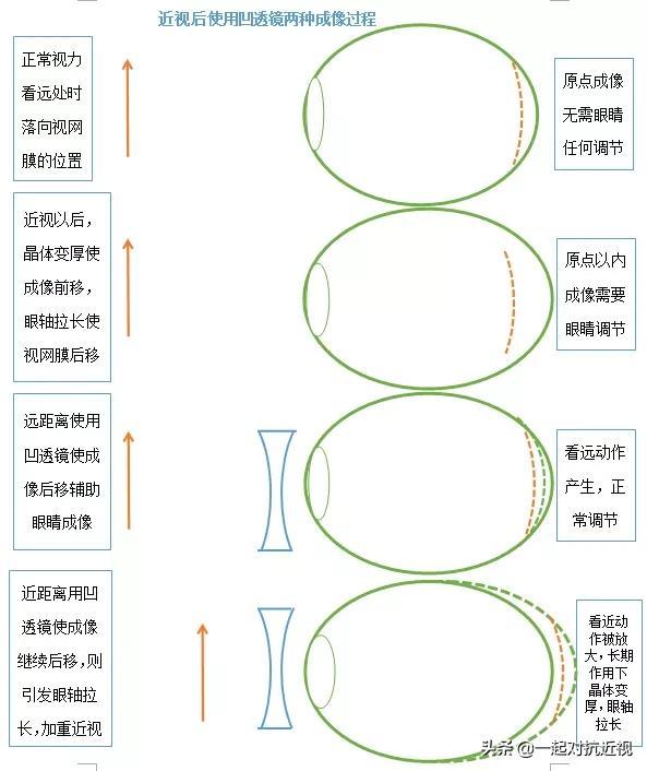 眼睛的成像原理示意图，眼睛所有成像过程一览