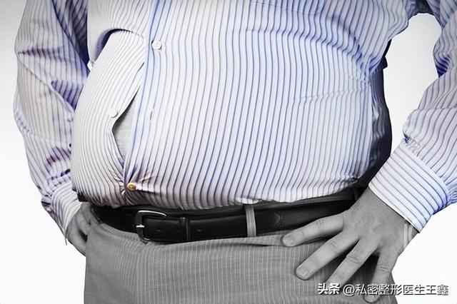 肥胖纹玻尿酸(肥胖纹可以淡化)